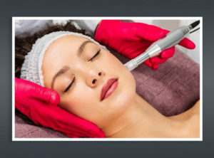 Micro Needling